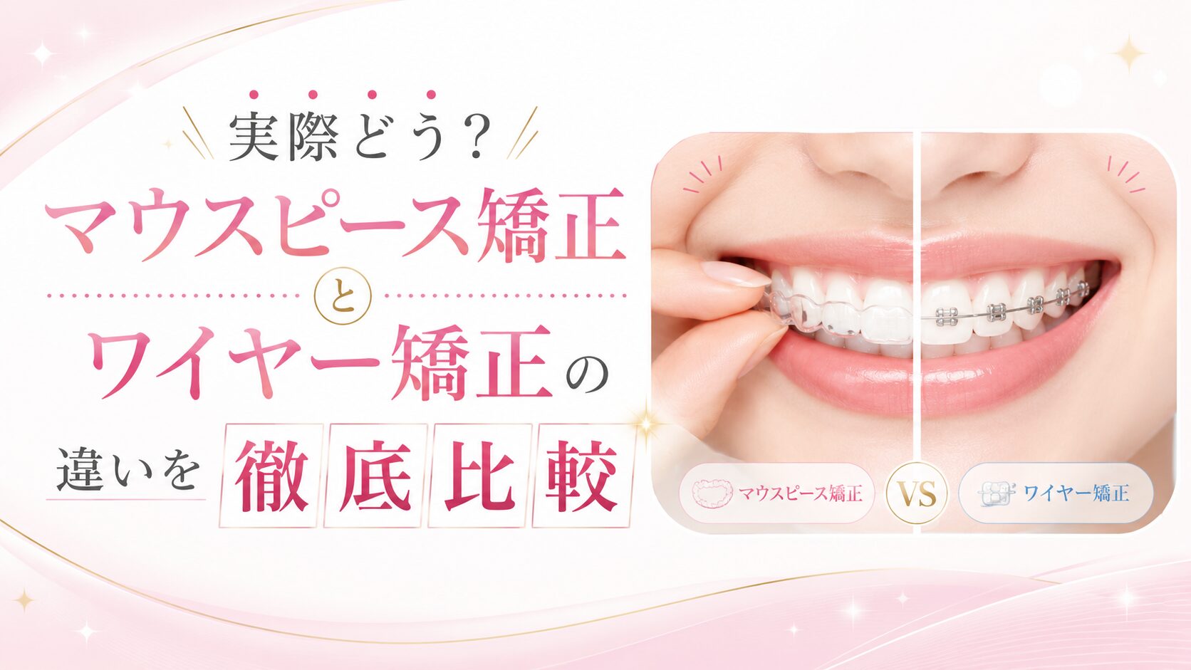実際どう？マウスピース矯正とワイヤー矯正の違いを徹底比較
