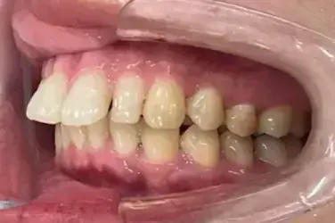 治療前