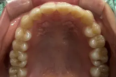 治療後